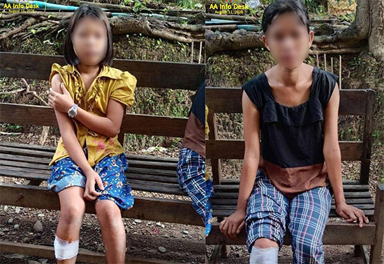 ပလက်ဝမြို့ပေါ်ကို စစ်တပ် ဗုံးကြဲ၍ ခူမီးအမျိုးသမီးငယ်နှစ်ဦး ဒဏ်ရာရ   သတင်းနှင့် မီဒီယာ ကွန်ရက်။ ၂၀၂၆ ခုနှစ်၊ ဩဂုတ်လ ၁၁ ရက်။   ချင်းပြည်၊ ပလက်ဝမြို့ပေါ်သို့ စစ်တပ်က ဂျက်ဖိုက်တာဖြင့် ဗုံးကြဲတိုက်ခိုက်ခဲ့သဖြင့် အပြစ်မဲ့ ဆယ်ကျော်သက် အရွယ် ခူမီးအမျိုးသမီးငယ်နှစ်ဦး ဗုံးစထိမှန်ကာ ဒဏ်ရာရရှိသွားခဲ့သည်။   ဩဂုတ်လ ၁၁ ရက် နံနက် ၇ နာရီခွဲခန့်တွင် ပလက်ဝမြို့အဝင် ဆိုင်းဘုတ်အနီးသို့ စစ်တပ်၏ ဂျက်ဖိုက် တာ တစ်စီး ရောက်ရှိလာပြီး ဗုံးနှစ်လုံး လာရောက်ကြဲချခဲ့ခြင်း ဖြစ်ကြောင်း အာရက္ခတပ်တော် AA က ထုတ်ပြန် သည်။   အဆိုပါ လေကြောင်းတိုက်ခိုက်မှုကြောင့် မြို့အဝင်ဝအနီးရှိ ဦးသောကြာ၏ နေအိမ်အား ဗုံးစများ ထိမှန်ခဲ့ပြီး ၎င်း၏သမီးဖြစ်သူ အသက် ၁၉ နှစ်အရွယ် မထွေးစိန် နှင့် ရေတံခွန်ကျေးရွာမှ ပလက်ဝမြို့တွင် Grade-6 ပညာလာရောက်သင်ကြားနေသည့် အသက် ၁၃ နှစ်အရွယ် မသန္တာထိုက်တို့ နှစ်ဦး စလုံး၏ ညာဘက်ခြေထောက် များ၌ ဗုံးစထိမှန် ဒဏ်ရာရရှိခဲ့သည်။   “မနက်ခင်းကြီး လေယာဉ်သံ ကြားလိုက်ရပြီး မကြာဘူး၊ မြို့အဝင်ဘက်မှာ ဗုံးကျပေါက်ကွဲသံ အကျယ်ကြီး ကြားလိုက်ရတာ။ အိမ်နားတင် လာကျတော့ အိမ်လည်း ထိသလို အိမ်မှာရှိနေတဲ့ ကလေးမလေးနှစ်ဦးလုံး ခြေထောက်တွေမှာ ဗုံးစထိမှန်သွားတယ်။ အခုတော့ ဒဏ်ရာရထားတဲ့သူတွေကို ဆေးကုသပေးနေရတယ်” ဟု ပလက်ဝမြို့ခံ အမျိုးသမီးတစ်ဦးက ပြောသည်။   ဒဏ်ရာရရှိသွားသည့် အမျိုးသမီးငယ်နှစ်ဦးမှာ ခူမီးတိုင်းရင်းသူများ ဖြစ်ကြပြီး လက်ရှိတွင် နီးစပ်ရာ၌ ဆေးကု သမှု ခံယူနေကြရသည်။   စစ်တပ်သည် စစ်ဘက်နှင့် မသက်ဆိုင်သည့် အရပ်သားပြည်သူများ နေထိုင်ရာ နေရာများကို နေ့စဉ်နှင့်အမျှ ပစ်မှတ်ထား ဗုံးကြဲတိုက်ခိုက်နေသဖြင့် လေကြောင်းနှင့် ရေကြောင်း အန္တရာယ်များကို ယခင်ထက် ပိုမိုဂရုစိုက် ကြရန် အာရက္ခတပ်တော် (AA) က အသိပေး တိုက်တွန်းထားသည်။   ပလက်ဝမြို့နယ်အတွင်း၌ ပြီးခဲ့သည့် မတ်လ ၂၉ ရက်ကလည်း စစ်တပ်က ကြောင်ချောင်းကျေးရွာကို ဂျက်ဖိုက် တာနှစ်စီးဖြင့် ဗုံးကြဲတိုက်ခိုက်ခဲ့သဖြင့် အပြစ်မဲ့ အရပ်သား ခုနစ်ဦး သေဆုံးကာ လေးဦး ဒဏ်ရာရရှိခဲ့ဖူးသည်။   ထို့ပြင် စစ်တပ်သည် ဩဂုတ်လ ၃ ရက်၊ ၄ ရက်၊ ၈ ရက်နှင့် ၁၀ ရက်နေ့တို့တွင်လည်း သံတွဲ၊ မြောက်ဦးနှင့် အမ်း စသည့် မြို့နယ်များရှိ အရပ်သားနေရာများကို နေ့ညမရွေး လေကြောင်းမှ ဆက်တိုက် ဗုံးကြဲတိုက်ခိုက်ခဲ့သဖြင့် အပြစ်မဲ့ပြည်သူများ သေဆုံးထိခိုက်မှု များပြားခဲ့သည့်အပြင် နေအိမ်များနှင့် တိရစ္ဆာန်များစွာ သေကျေပျက်စီး ဆုံးရှုံးခဲ့ရသည်။   ဓာတ်ပုံ - AA Info Desk   #ပလက်ဝ